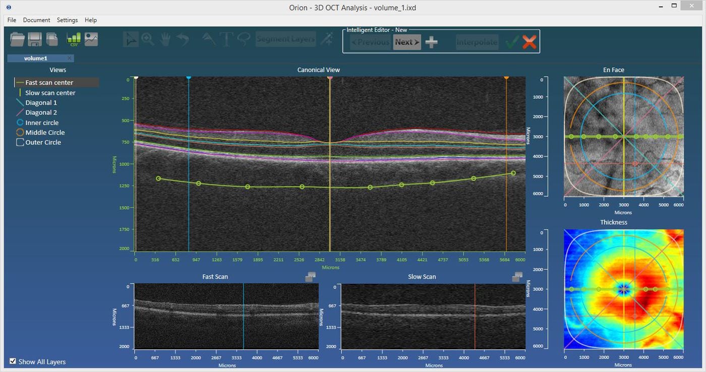 With Orion's intelligent editing wizard, surfaces may be edited or indeed added in seconds.