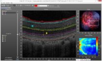 InSight 3d screen shot InSight 3d screen shot