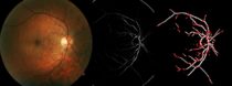 fundus fundus